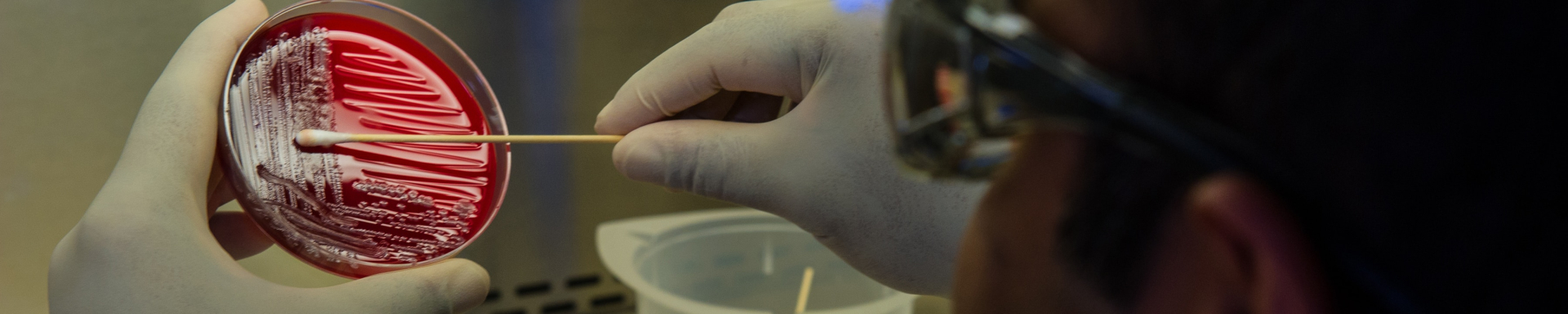 Uma amostra de sangue está sendo analisada em um laboratório